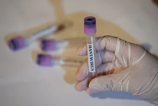 HANTAVIRUS : SOIGNANTS, PASSAGERS DE TRAIN ET D’AVION… LES CAS CONTACT DU TOURISTE AYANT SÉJOURNÉ EN FRANCE IDENTIFIÉS