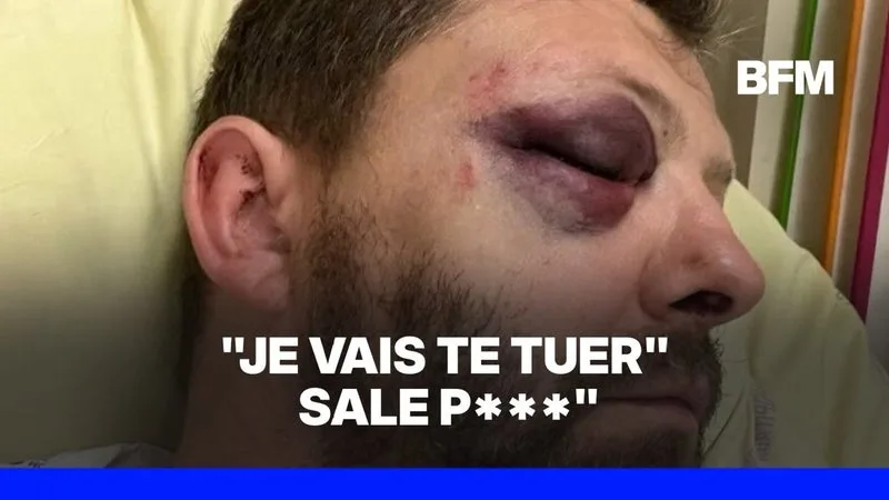 UN POLICIER VICTIME D’UNE AGRESSION HOMOPHOBE À PARIS TÉMOIGNE