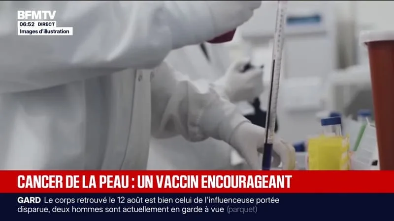 LES LABORATOIRES MODERNA ET MERCK ANNONCENT DES RÉSULTATS ENCOURAGEANTS DE LEUR VACCIN EXPÉRIMENTAL CONTRE LE CANCER DE LA PEAU