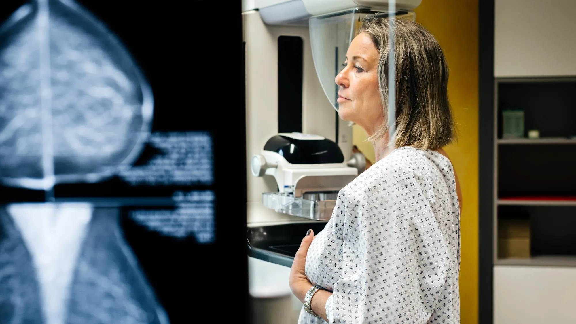 CANCER : UNE ÉTUDE RÉVÈLE COMMENT LES INÉGALITÉS SOCIALES IMPACTENT LES RISQUES