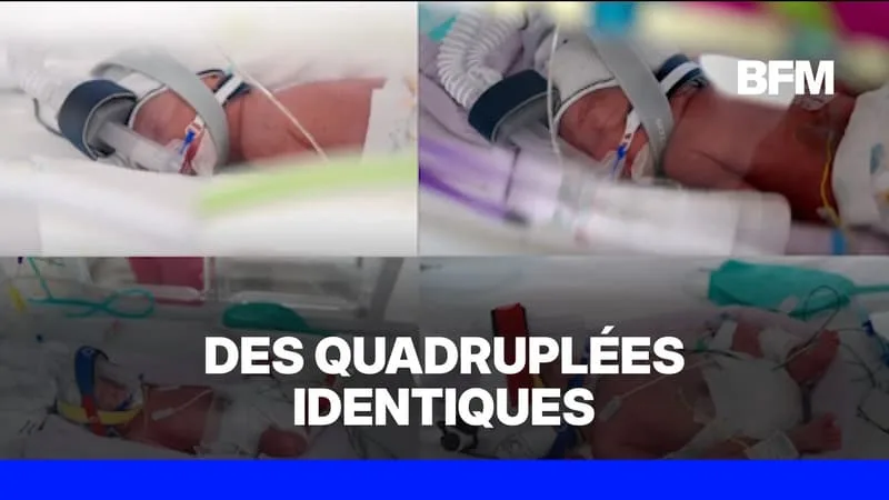 AUSTRALIE: UNE FEMME DONNE NAISSANCE À DES QUADRUPLÉES IDENTIQUES