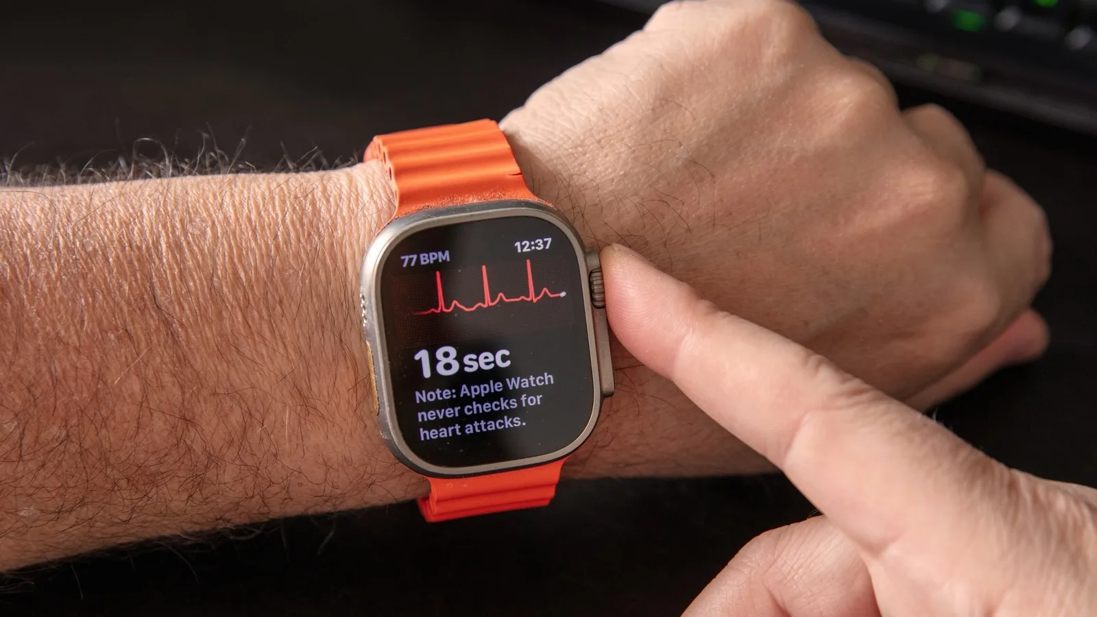 APPLE NOUS AVAIT PROMIS UN REDESIGN DE SON APP SANTÉ … FINALEMENT, ÇA ATTENDRA