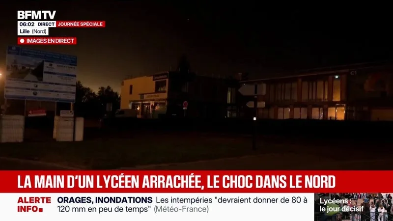 « MAIN ARRACHÉE », IGPN SAISIE..: CE QUE L’ON SAIT DE LA GRAVE BLESSURE D’UN LYCÉEN LORS D’UNE MANIFESTATION À LENS