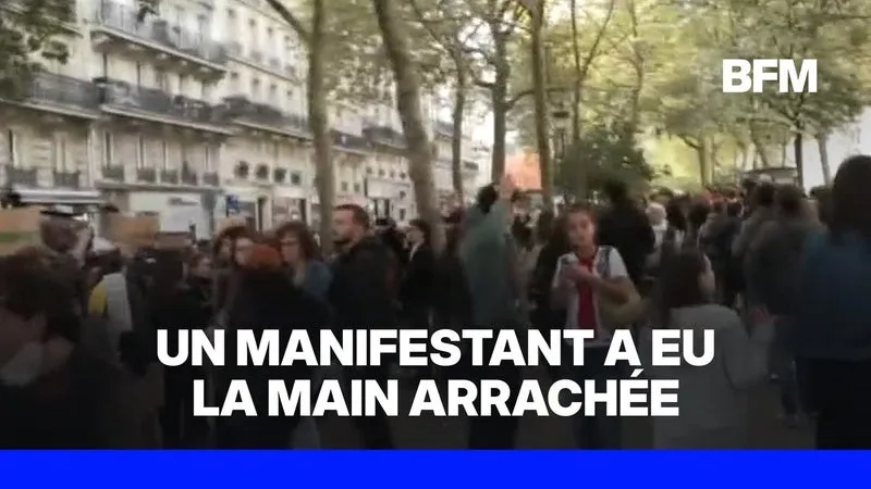 MOBILISATIONS DU 17 OCTOBRE: UN MANIFESTANT A EU LA MAIN ARRACHÉE À SAINT-ÉTIENNE